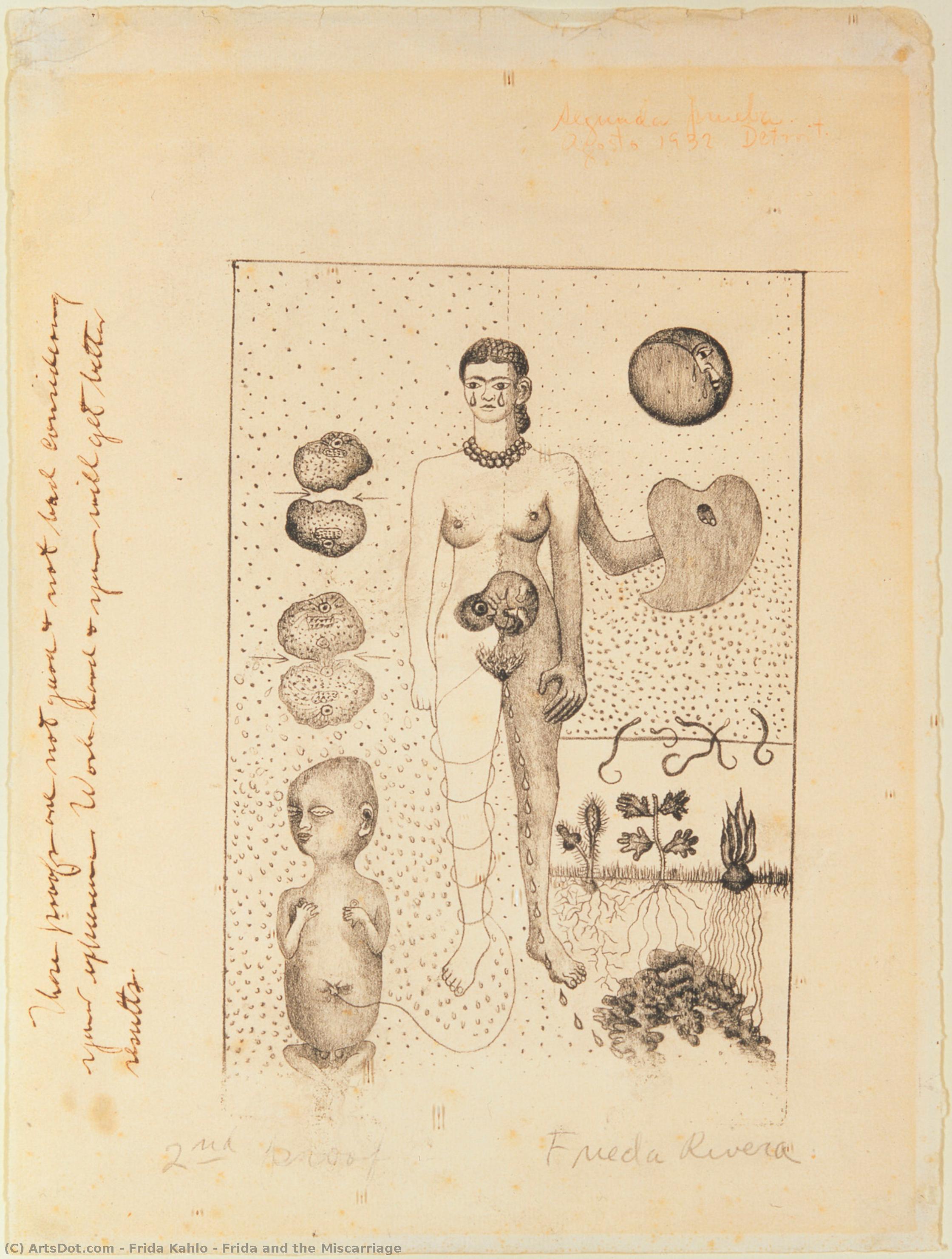 Frida And The Miscarriage — Frida Kahlo