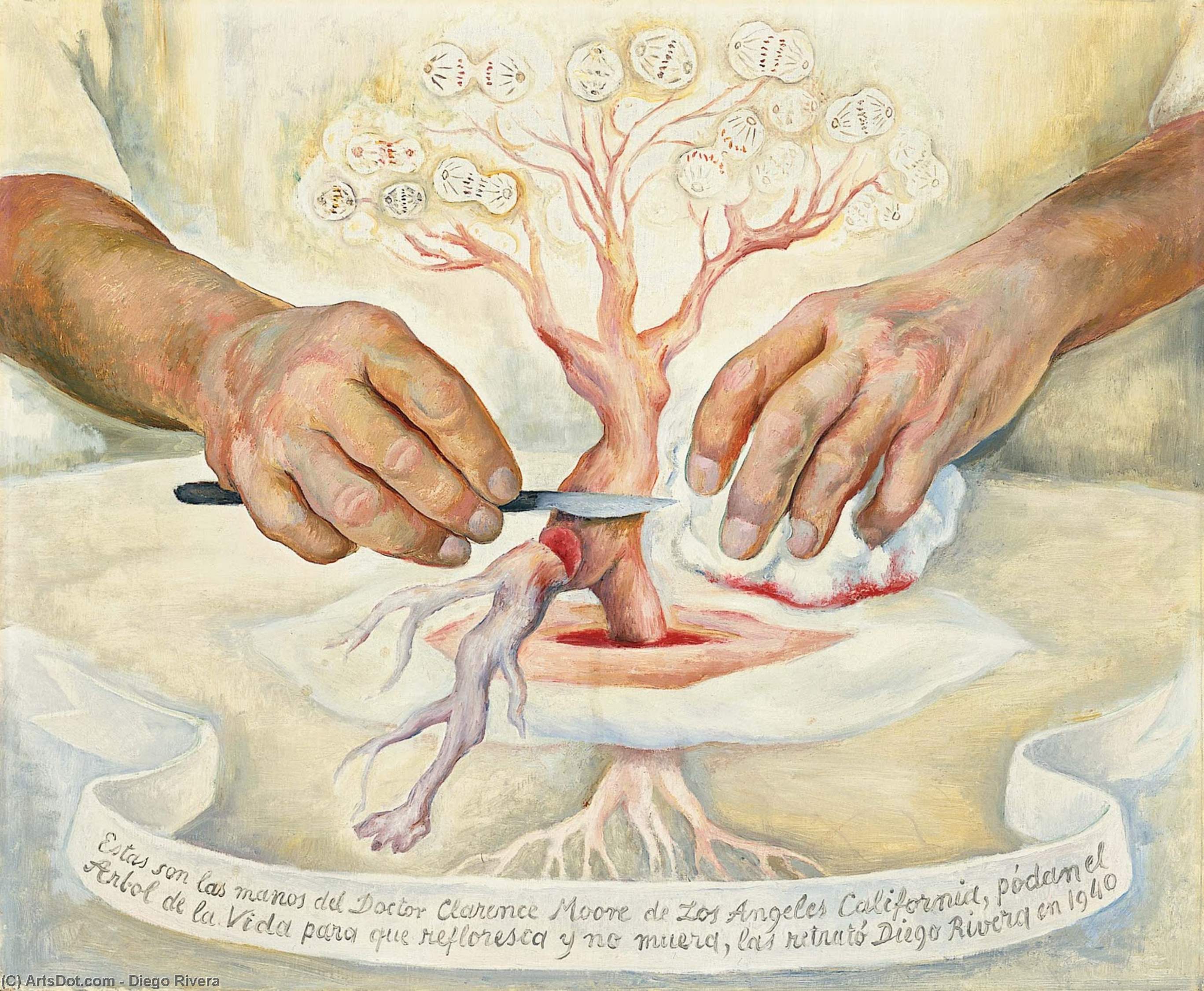 Le Mani Del Dr. Moore — Diego Rivera