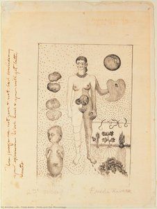 Frida And The Miscarriage — Frida Kahlo
